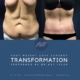 Before and After Tummy Tuck Surgery on 60 year old female patient