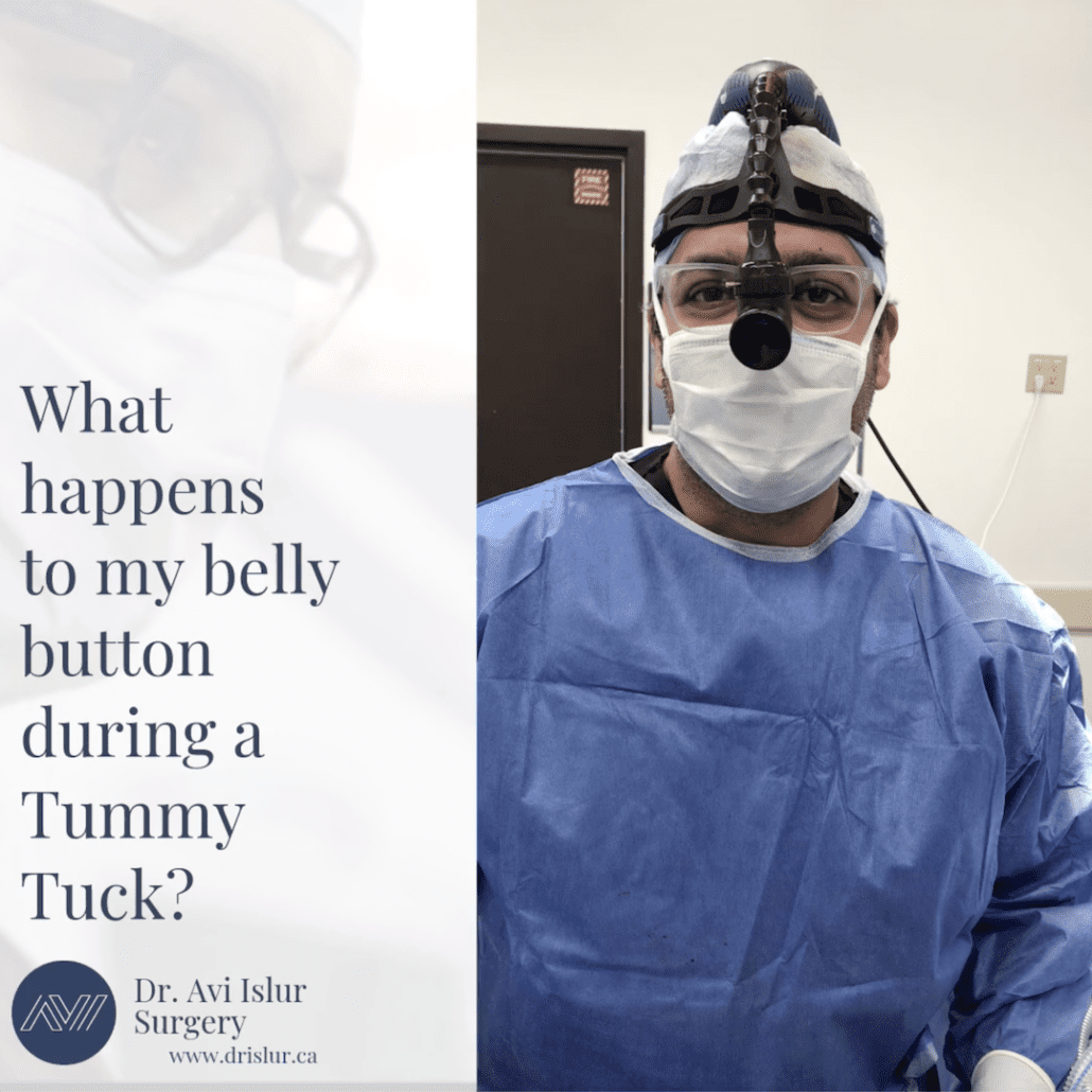 tummy tuck belly button gone