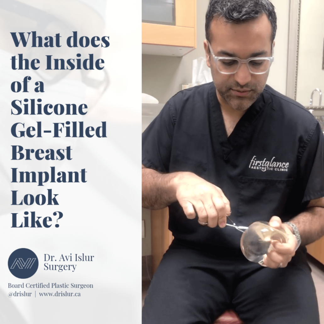 Dr Avi Islur Plastic Surgeon Winnipeg MB breast implants
